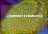 LOL英雄界面皮肤异常全解析与自救指南